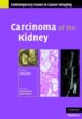 Carcinoma of the Kidney (eBook, PDF) - Bild 1