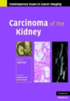 Cover Carcinoma of the Kidney (eBook, PDF)