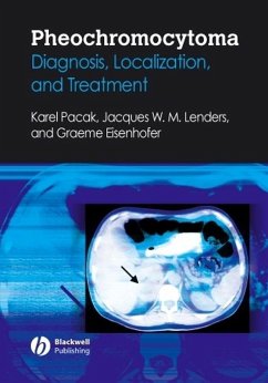 Pheochromocytoma (eBook, PDF) - Pacak, Karel; Eisenhofer, Graeme; Lenders, Jacques