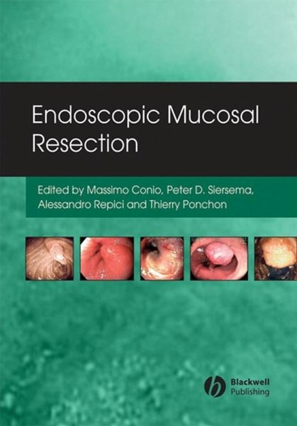 Endoscopic Mucosal Resection (eBook, PDF) Endoscopic Mucosal Resection (eBook, PDF)