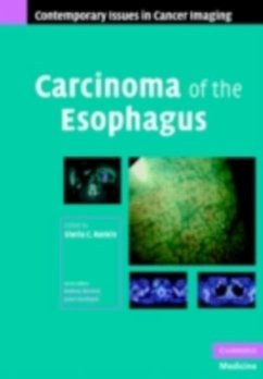 Cover Carcinoma of the Esophagus (eBook, PDF)