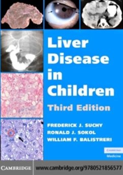 Cover Liver Disease in Children (eBook, PDF)