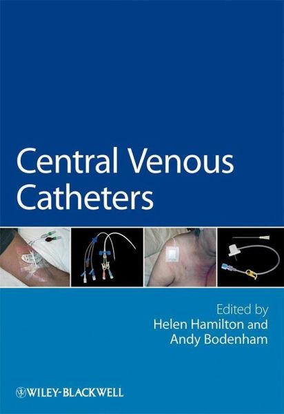 Central Venous Catheters (eBook, PDF)