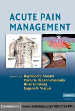 Acute Pain Management (eBook, PDF)