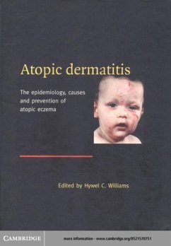 Atopic Dermatitis (eBook, PDF)