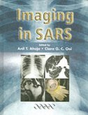 Imaging in SARS (eBook, PDF)