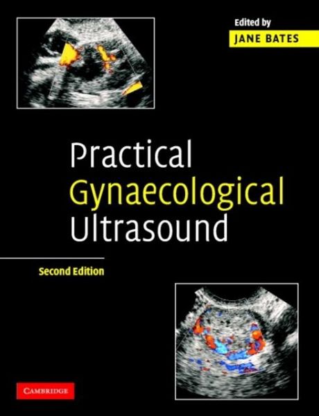 Practical Gynaecological Ultrasound (eBook, PDF)