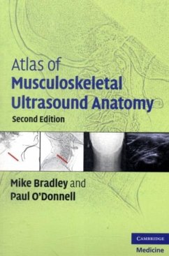 Atlas of Musculoskeletal Ultrasound Anatomy (eBook, PDF) - Bradley, Mike