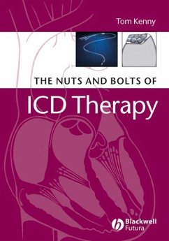 The Nuts and Bolts of ICD Therapy (eBook, PDF) - Kenny, Tom