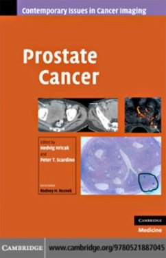 Cover Prostate Cancer (eBook, PDF)