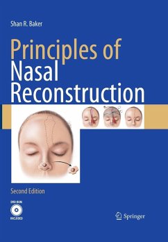 Principles of Nasal Reconstruction (eBook, PDF) - Baker, Shan R.