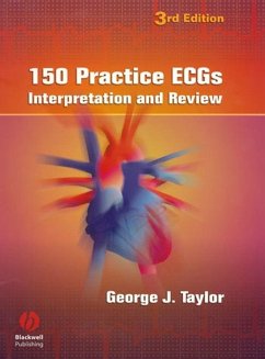 Cover 150 Practice ECGs (eBook, PDF)