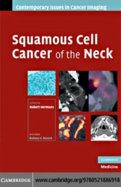 Cover Squamous Cell Cancer of the Neck (eBook, PDF)