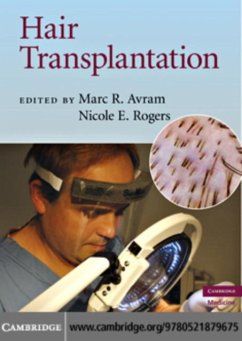 Cover Hair Transplantation (eBook, PDF)