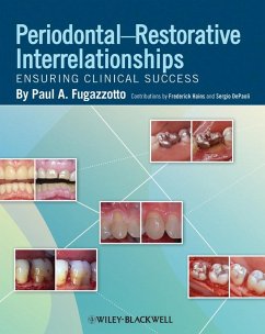 Periodontal-Restorative Interrelationships (eBook, ePUB) - Fugazzotto, Paul A.; Hains, Frederick; Depaoli, Sergio