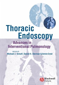 Thoracic Endoscopy (eBook, PDF)
