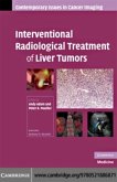 Interventional Radiological Treatment of Liver Tumors (eBook, PDF)