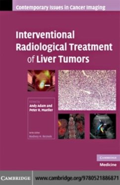 Interventional Radiological Treatment of Liver Tumors (eBook, PDF)