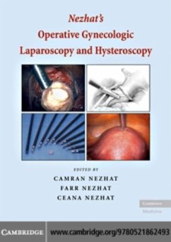 Nezhat's Operative Gynecologic Laparoscopy and Hysteroscopy (eBook, PDF) - Nezhat, Camran