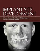 Implant Site Development (eBook, PDF)