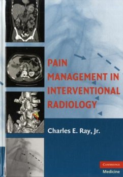 Pain Management in Interventional Radiology (eBook, PDF)