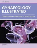 Gynaecology Illustrated E-Book (eBook, ePUB)