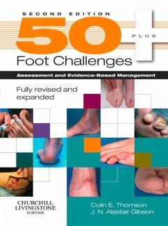 50+ Foot Challenges (eBook, ePUB) - Thomson, FCPod(S); Gibson MD, FRCS(orth)
