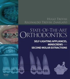 State-of-the-Art Orthodontics E-Book (eBook, ePUB) - Trevisi, Hugo; Zanelato, Reginaldo C. Trevisi