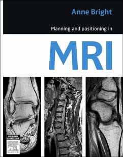 Cover Planning and Positioning in MRI - E-Book (eBook, ePUB)