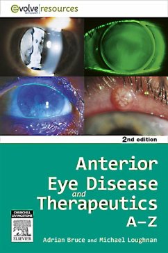 Anterior Eye Disease and Therapeutics A-Z - E-Book (eBook, ePUB) - Bruce, Adrian S.; Loughnan, Michael Stephen