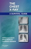 The Chest X-Ray: A Survival Guide (eBook, ePUB)