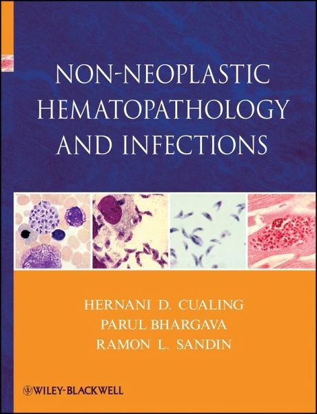 Non-Neoplastic Hematopathology and Infections (eBook, ePUB) Non-Neoplastic Hematopathology and Infections (eBook, ePUB)