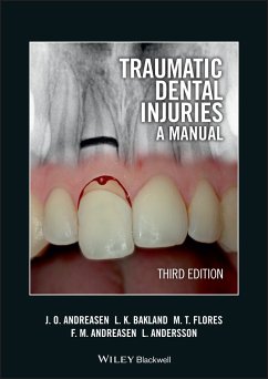 Traumatic Dental Injuries (eBook, PDF) - Andreasen, Jens O.; Bakland, Leif K.; Flores, Maria Teresa; Andreasen, Frances M.; Andersson, Lars