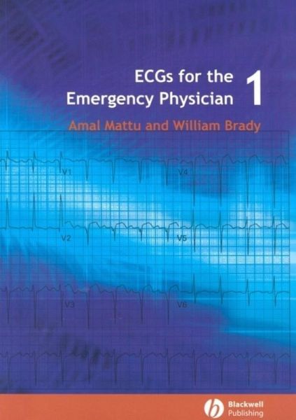 ECGs for the Emergency Physician 1 (eBook, PDF) ECGs for the Emergency Physician 1 (eBook, PDF)