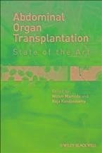 Abdominal Organ Transplantation (eBook, ePUB)