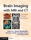 Brain Imaging with MRI and CT (eBook, PDF)