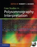 Case Studies in Polysomnography Interpretation (eBook, PDF)