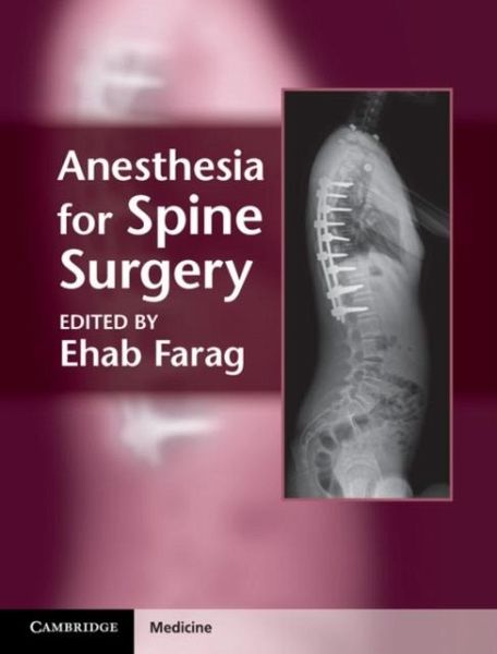 Anesthesia for Spine Surgery (eBook, PDF)