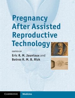 Pregnancy After Assisted Reproductive Technology (eBook, PDF)