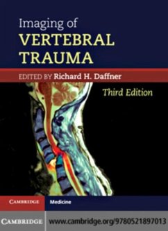 Cover Imaging of Vertebral Trauma (eBook, PDF)