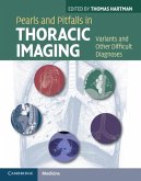 Pearls and Pitfalls in Thoracic Imaging (eBook, PDF)