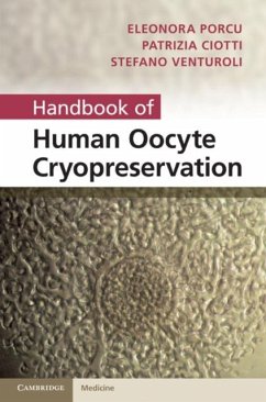 Cover Handbook of Human Oocyte Cryopreservation (eBook, PDF)