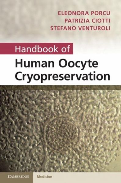 Handbook of Human Oocyte Cryopreservation (eBook, PDF) Handbook of Human Oocyte Cryopreservation (eBook, PDF)