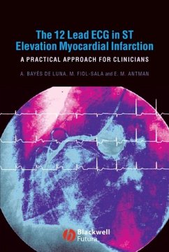 The 12 Lead ECG in ST Elevation Myocardial Infarction (eBook, PDF) - Bayés de Luna, Antoni; Fiol-Sala, Miquel; Antman, Elliot M.