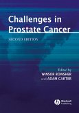 Challenges in Prostate Cancer (eBook, PDF)