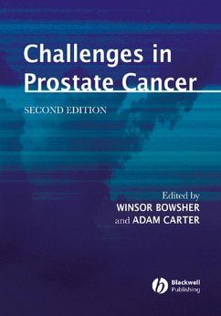 Cover Challenges in Prostate Cancer (eBook, PDF)