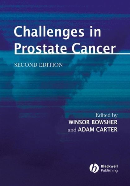 Challenges in Prostate Cancer (eBook, PDF) Challenges in Prostate Cancer (eBook, PDF)