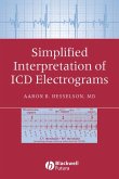 Simplified Interpretation of ICD Electrograms (eBook, PDF)