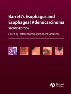 Cover Barrett's Esophagus and Esophageal Adenocarcinoma (eBook, PDF)