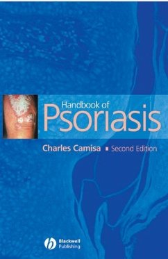 Cover Handbook of Psoriasis (eBook, PDF)